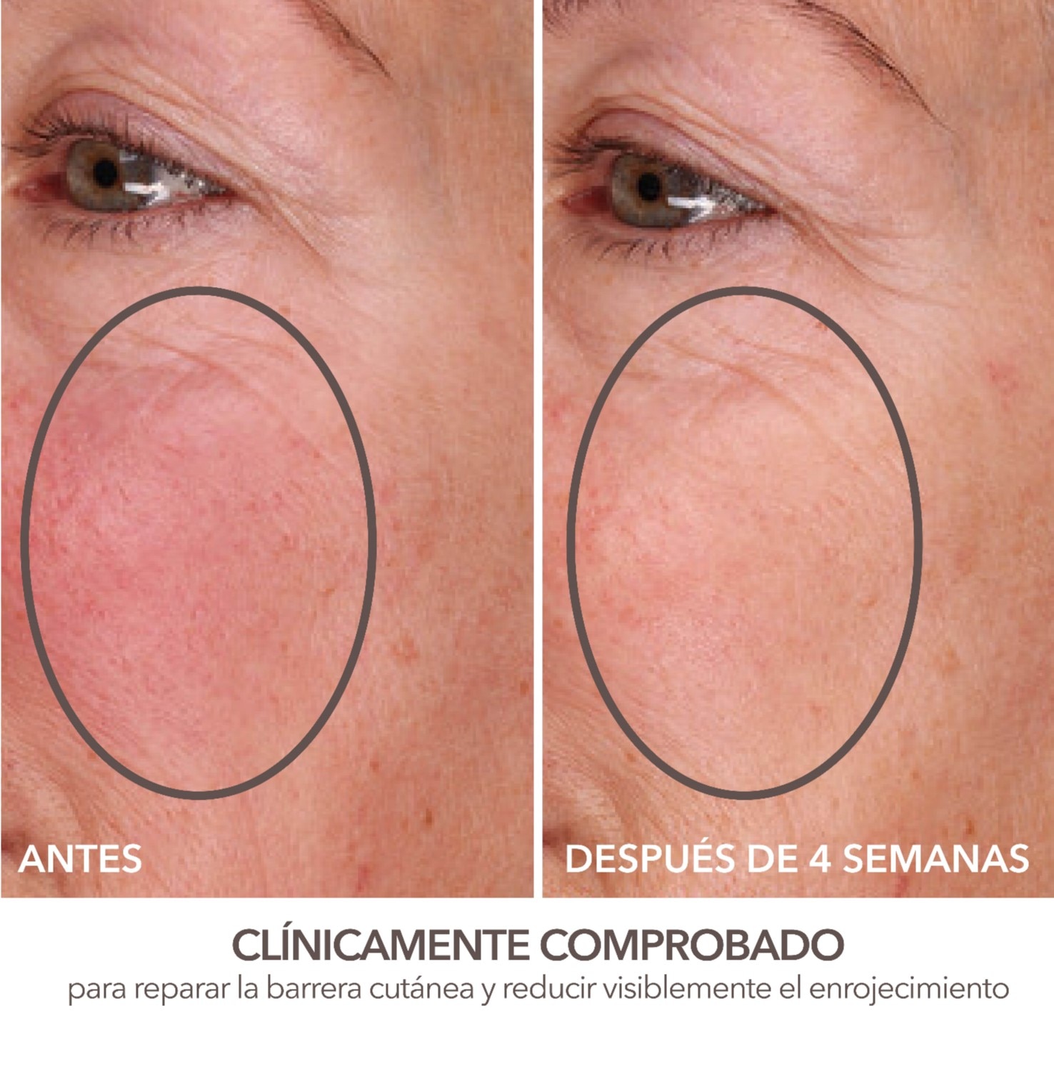 DERMINFUSIONS ™ FILL + REPAIR SERUM (SUERO PARA ROSTRO)